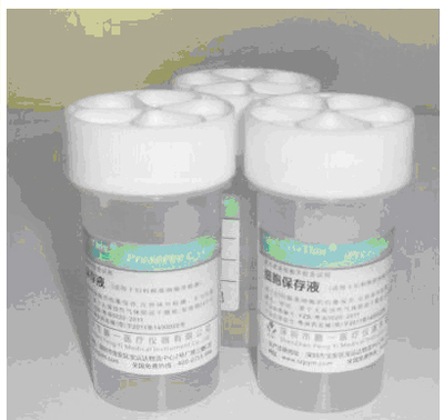 自动液基细胞制片染色(TCT)检测